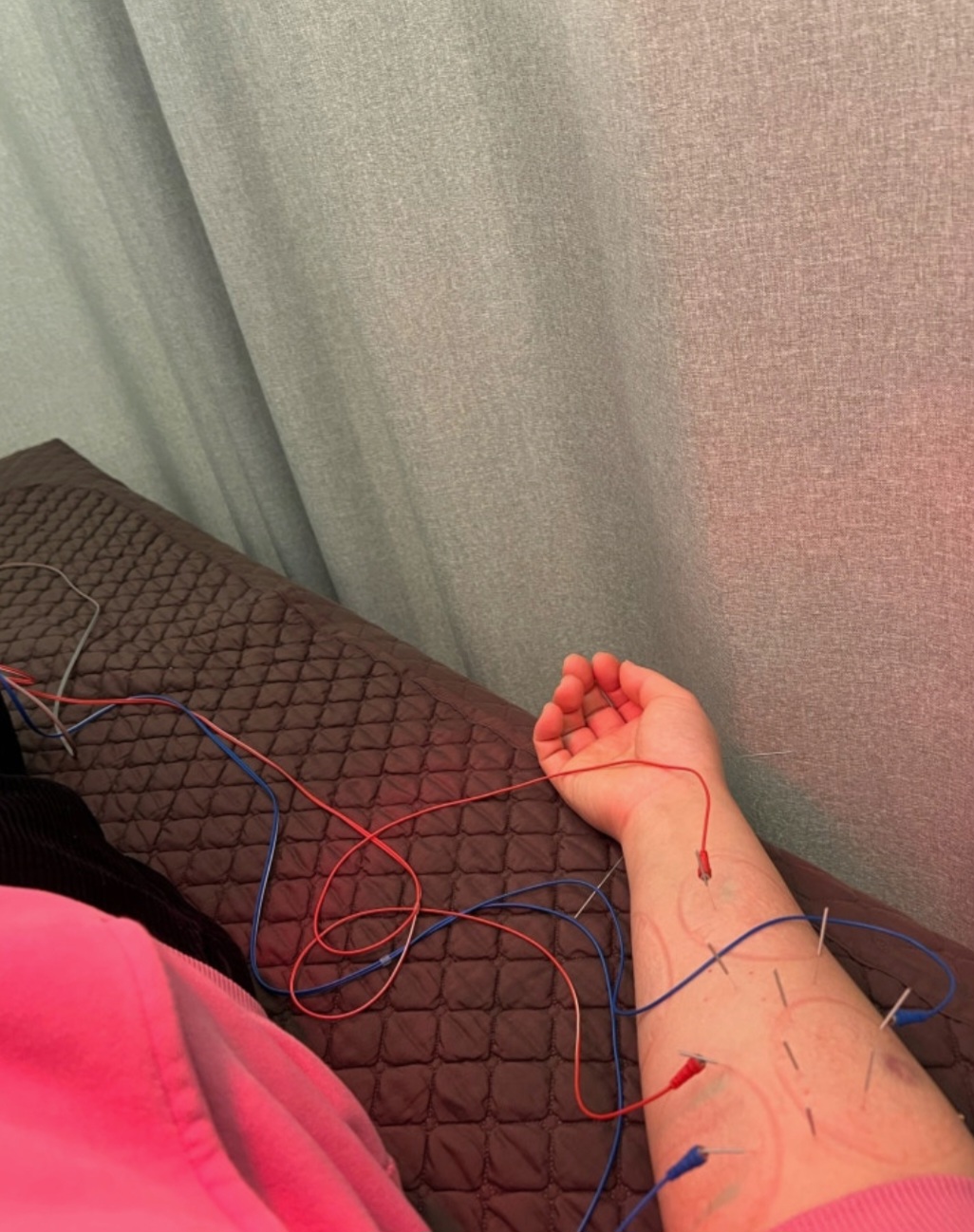 부평구 갈산한의원, 물리치료로 팔목 통증 반으로 줄어!