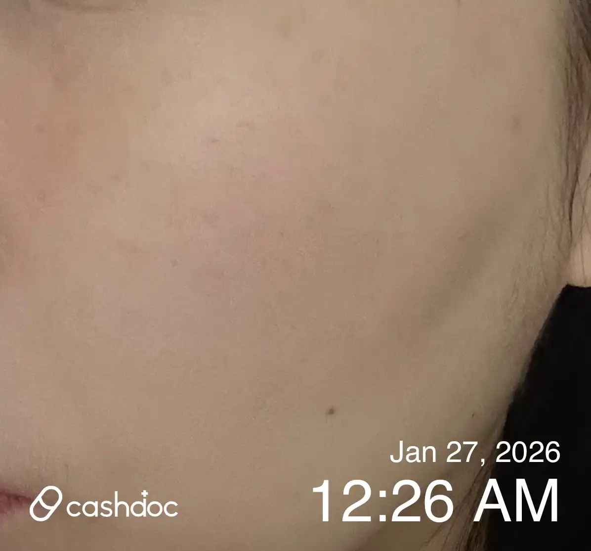 Review photo