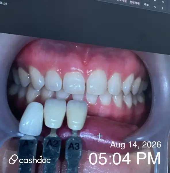 Review photo