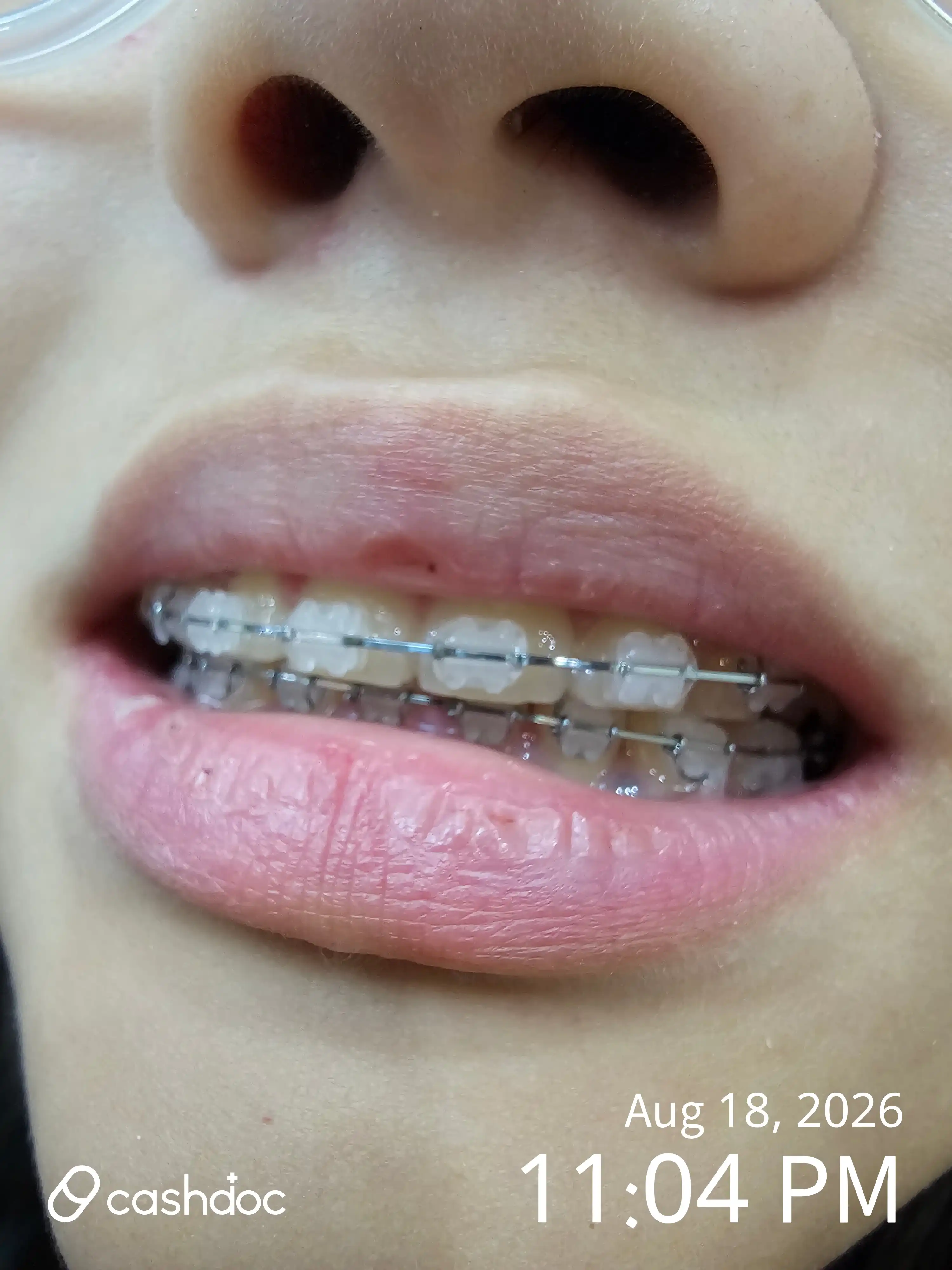Review photo