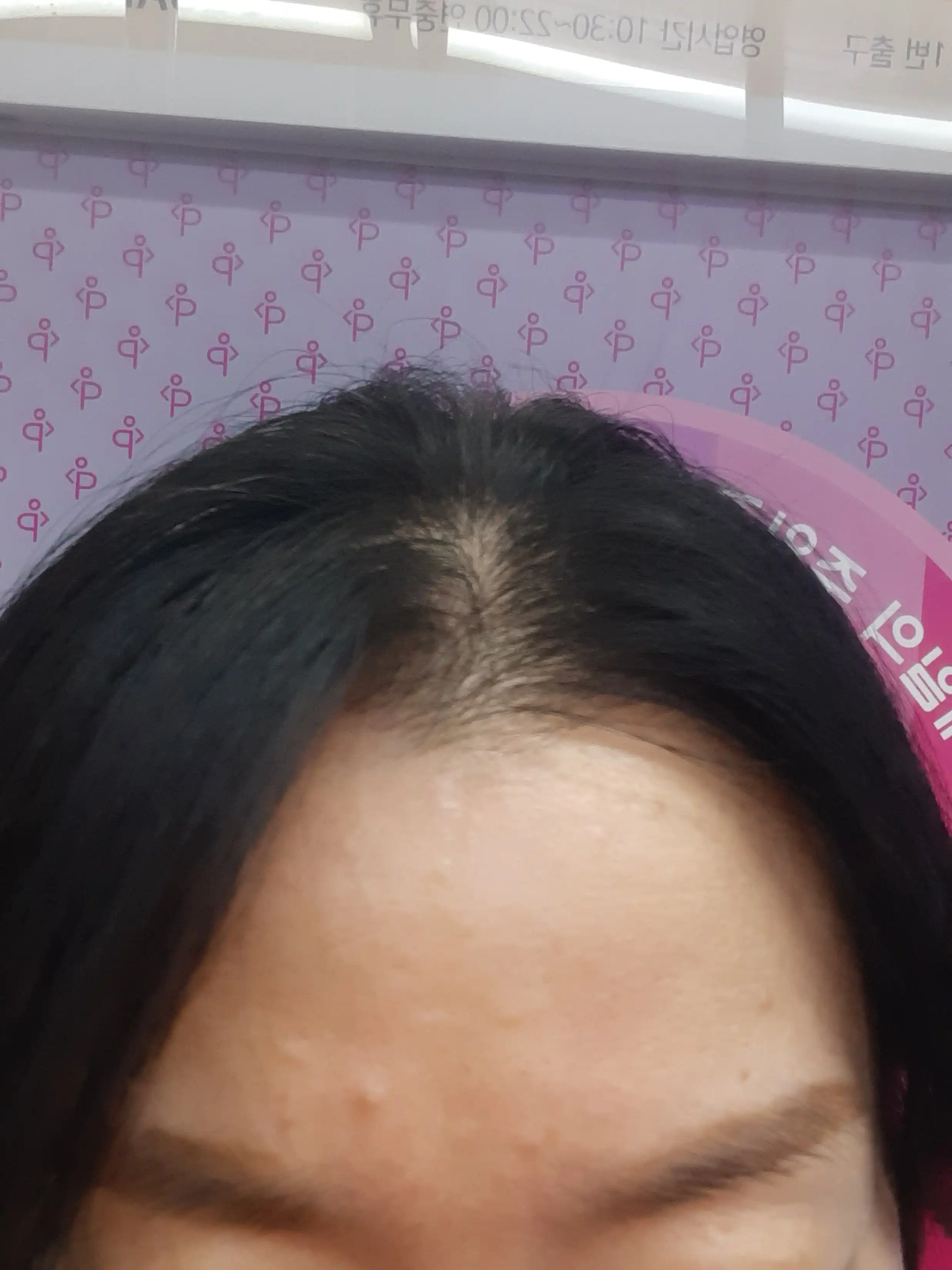 후