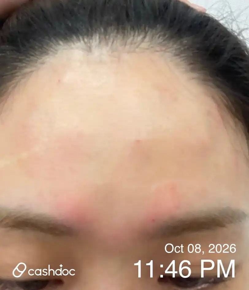 메이퓨어의원 위례중앙점 후기 사진