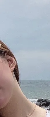 시술 전 — V라인 윤곽/아큐/라인/리즈핏 주사