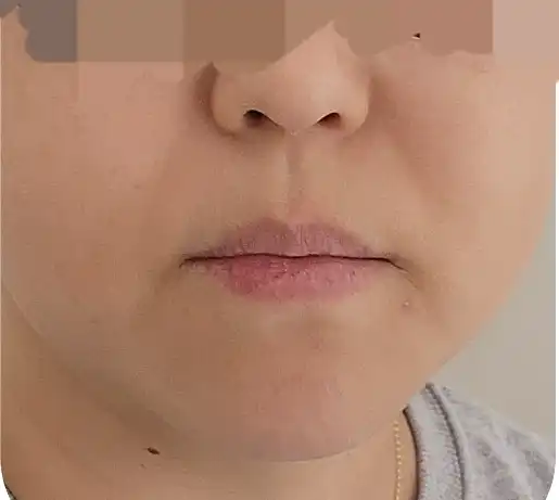 전