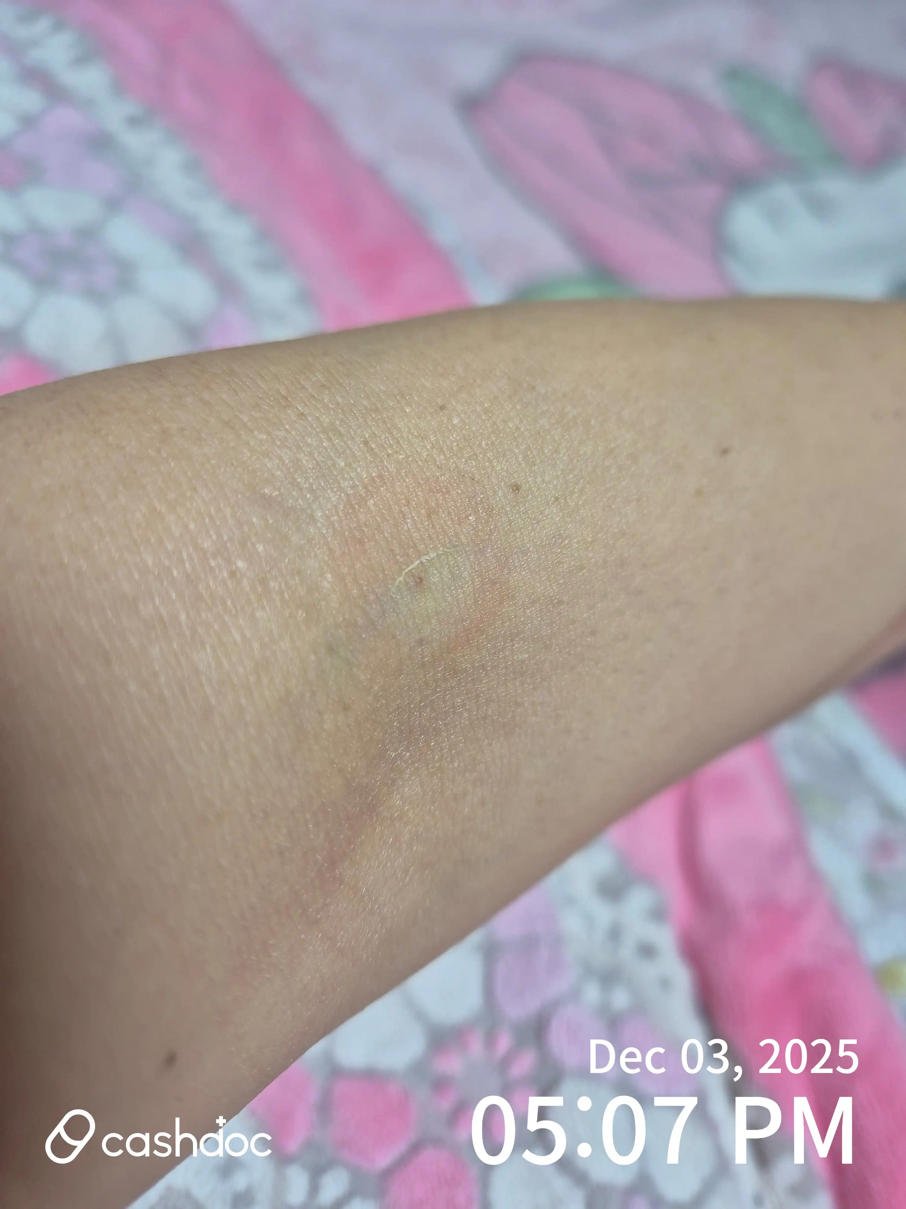 评价照片