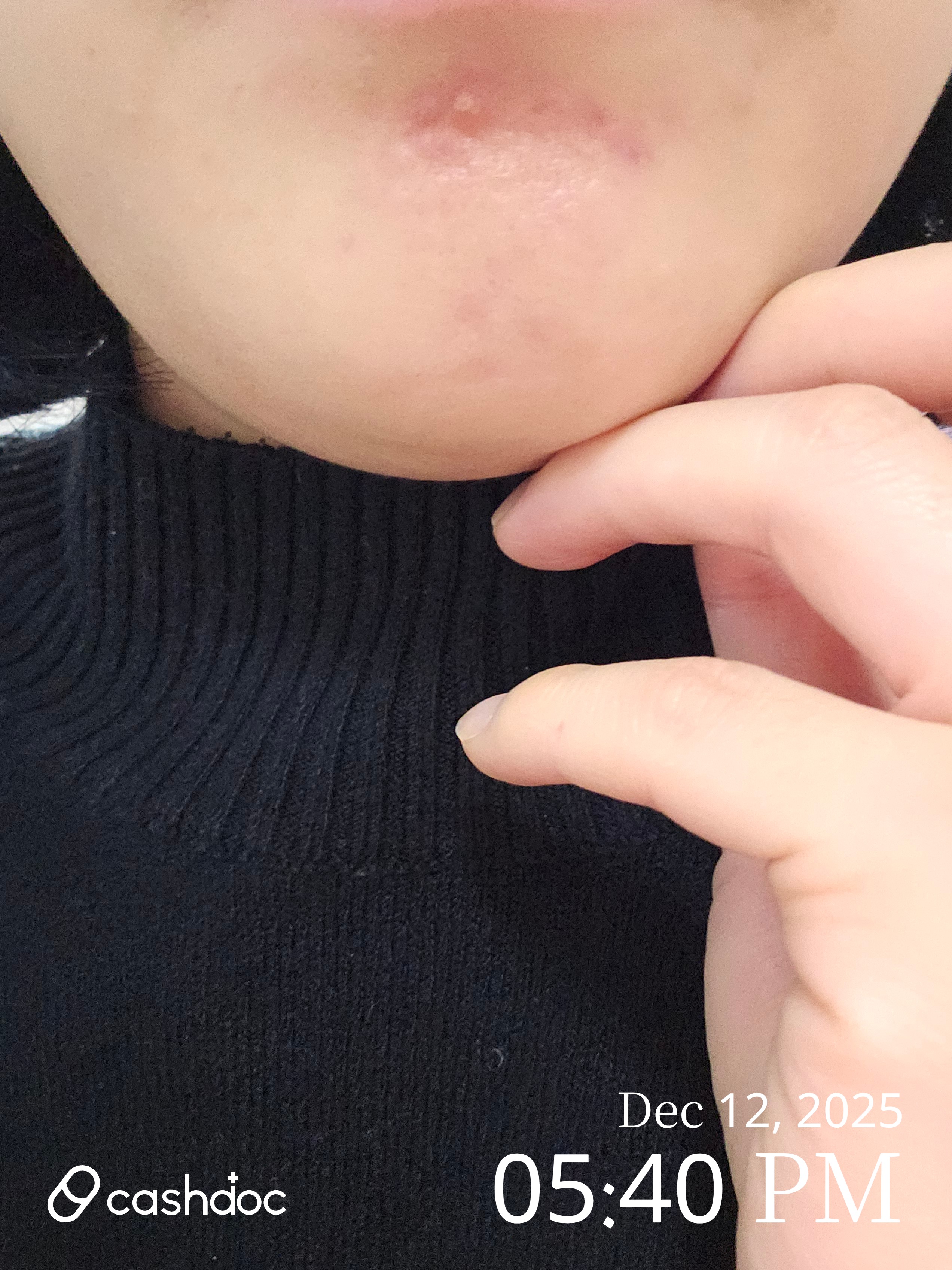 성남시 늘푸른피부과의원, 친절하고 신뢰가는 염증 치료 경험