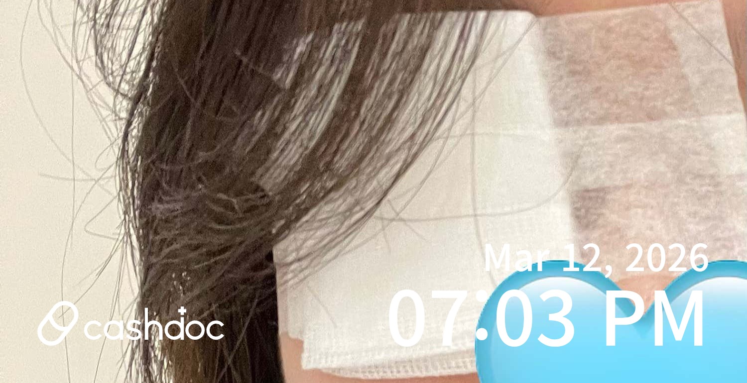 중부우리안과의원에서 다래끼 수술, 빠르고 깔끔해요