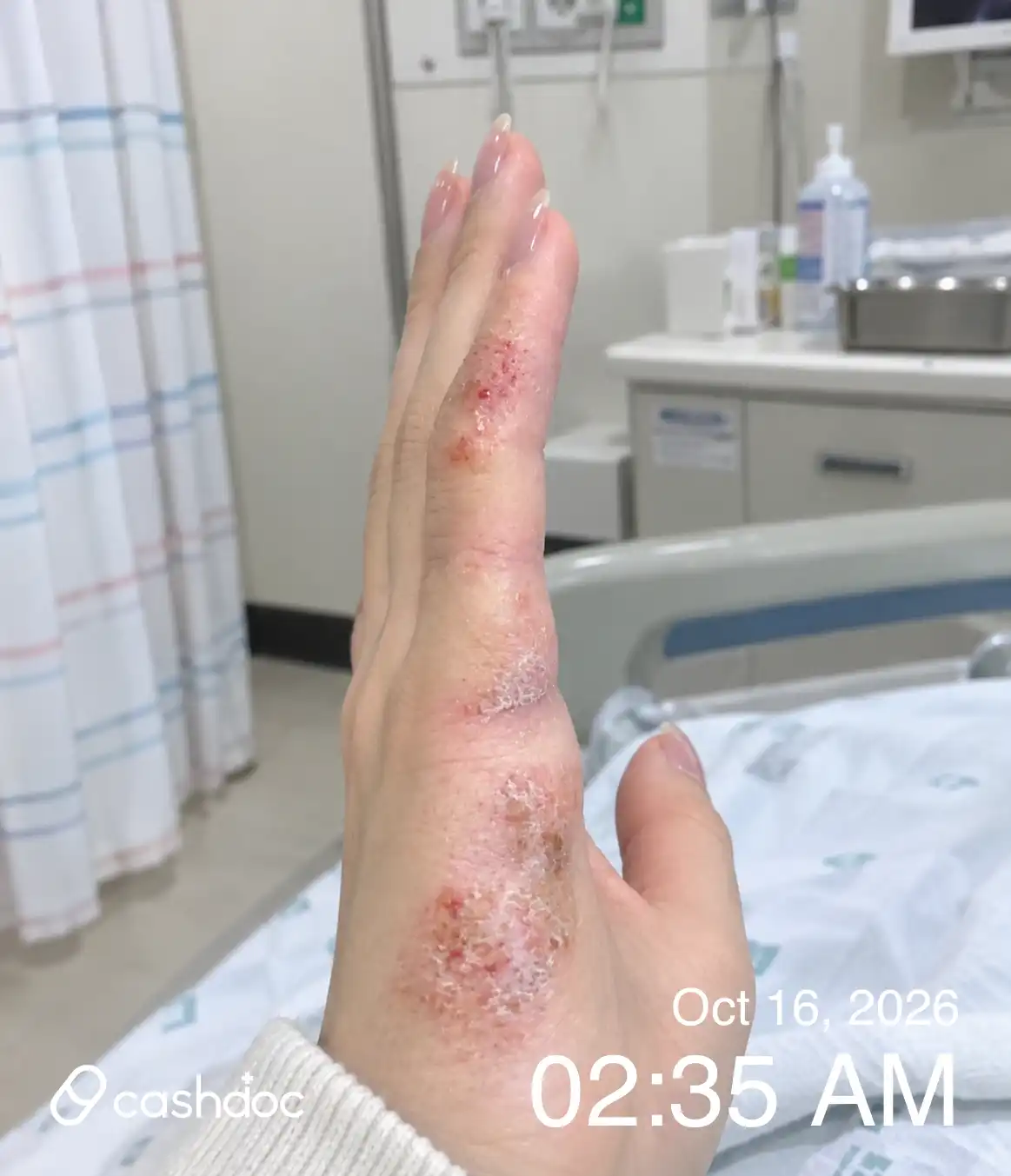 评价照片