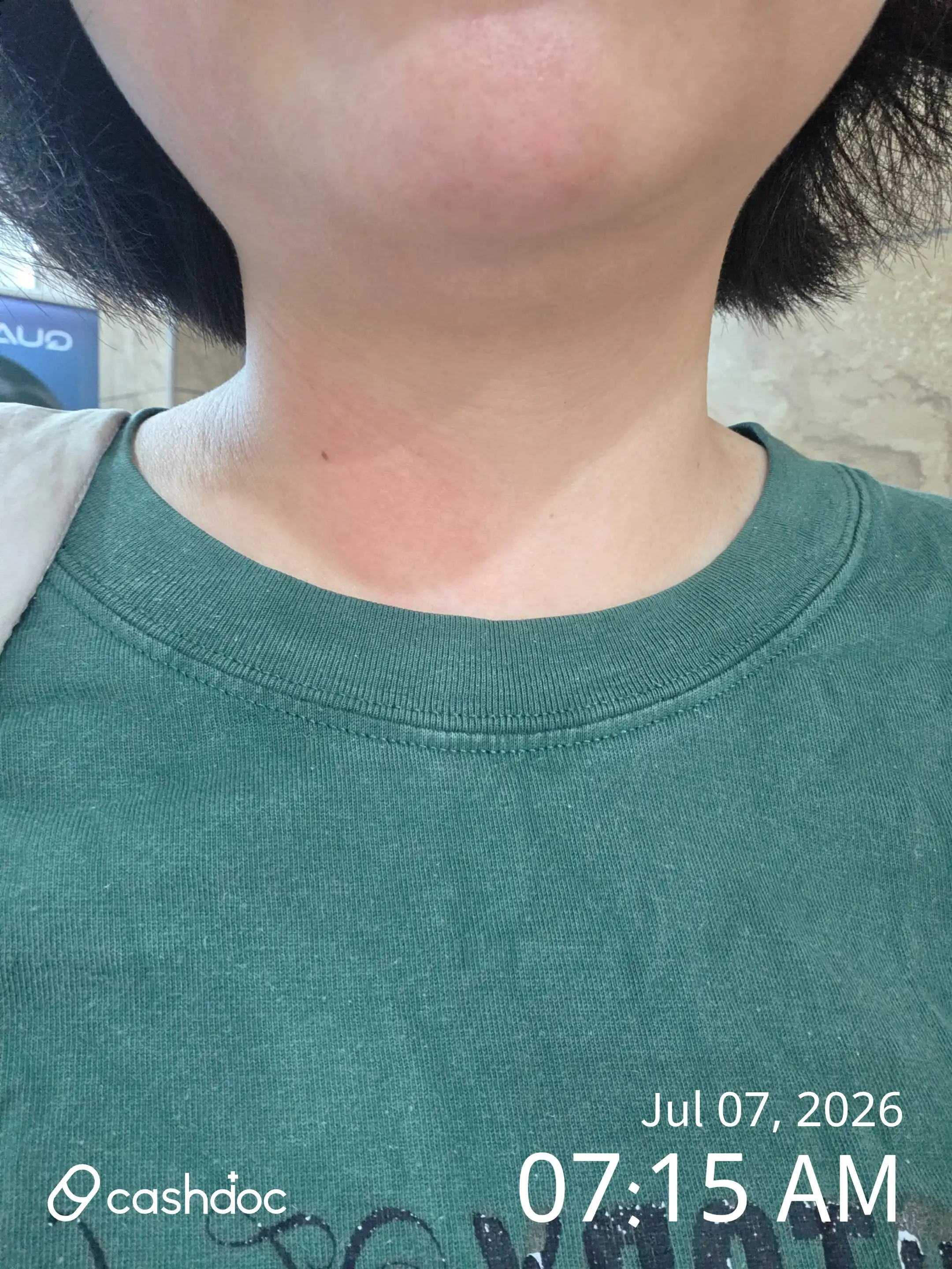 Review photo