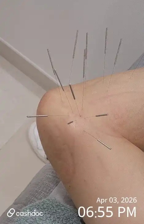 评价照片