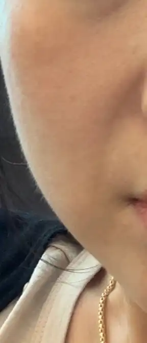 후