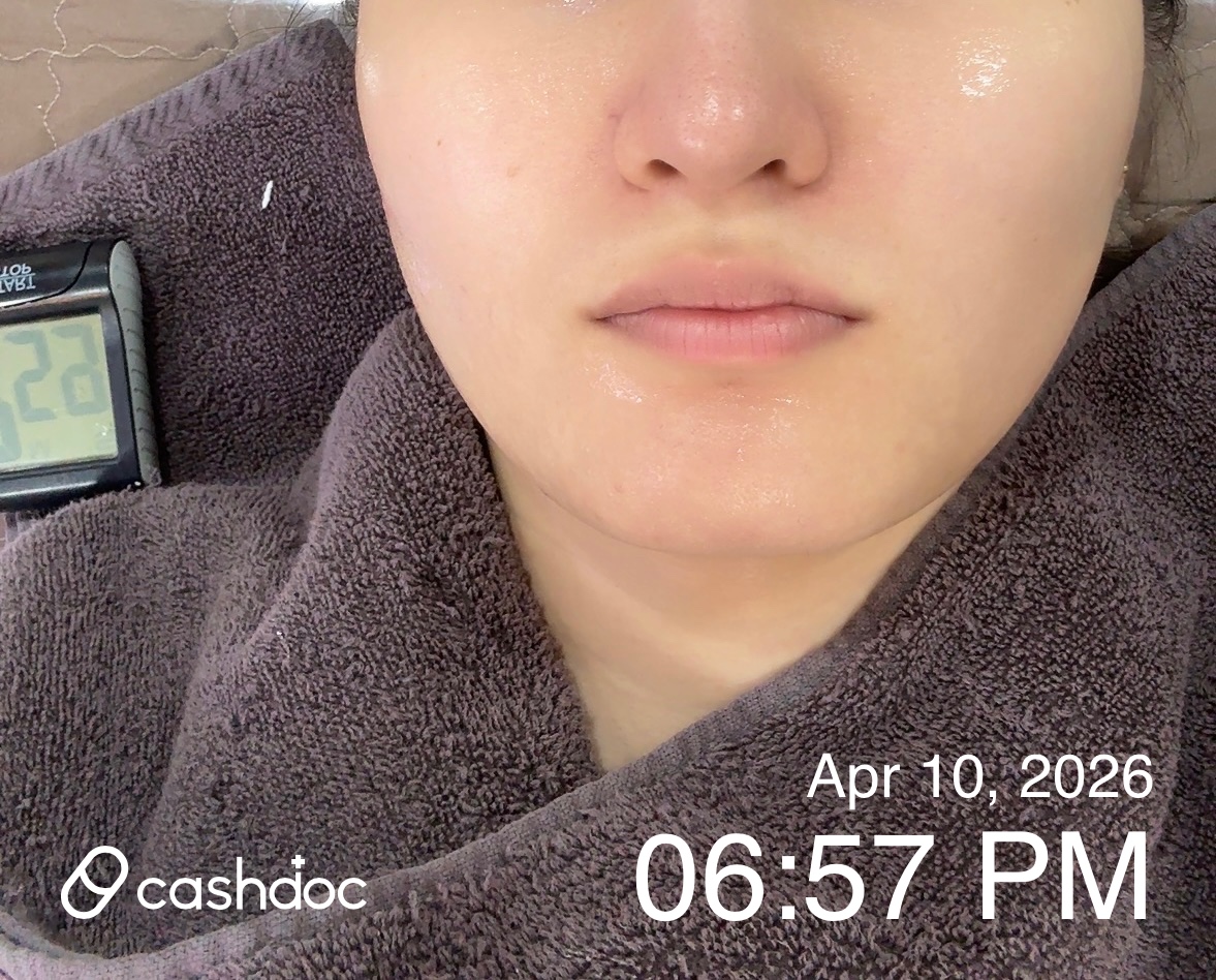 영등포구 메이퓨어의원, 여드름 압출 가성비 좋아요