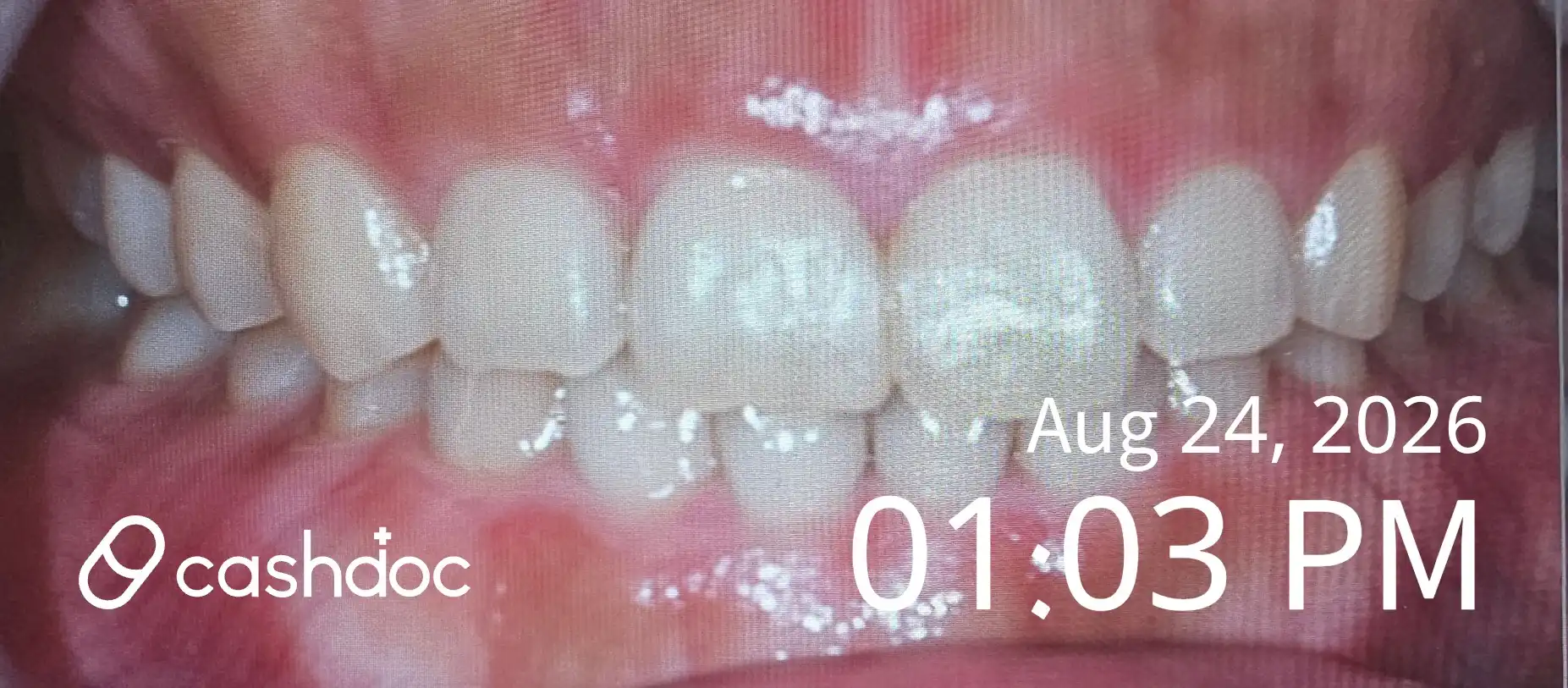 评价照片