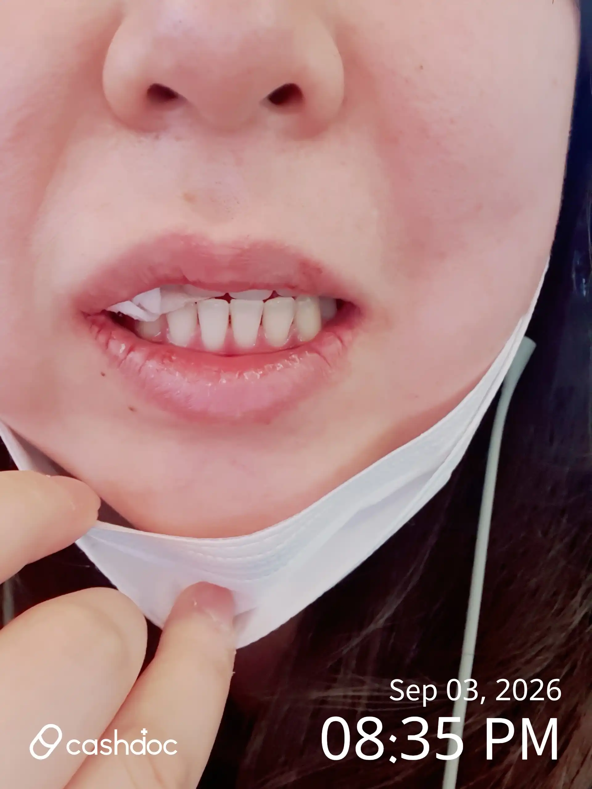 Review photo