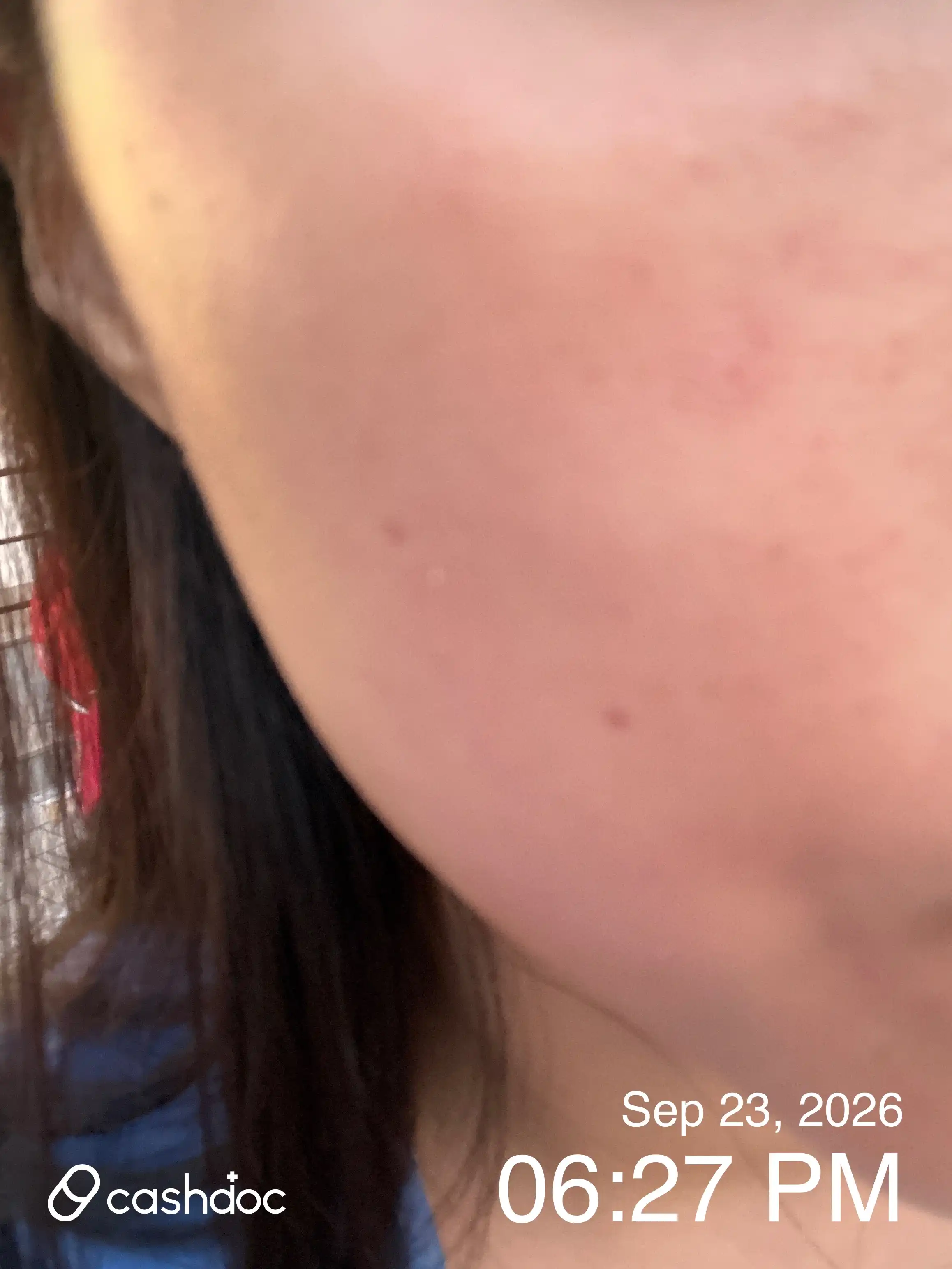 Review photo