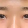 後