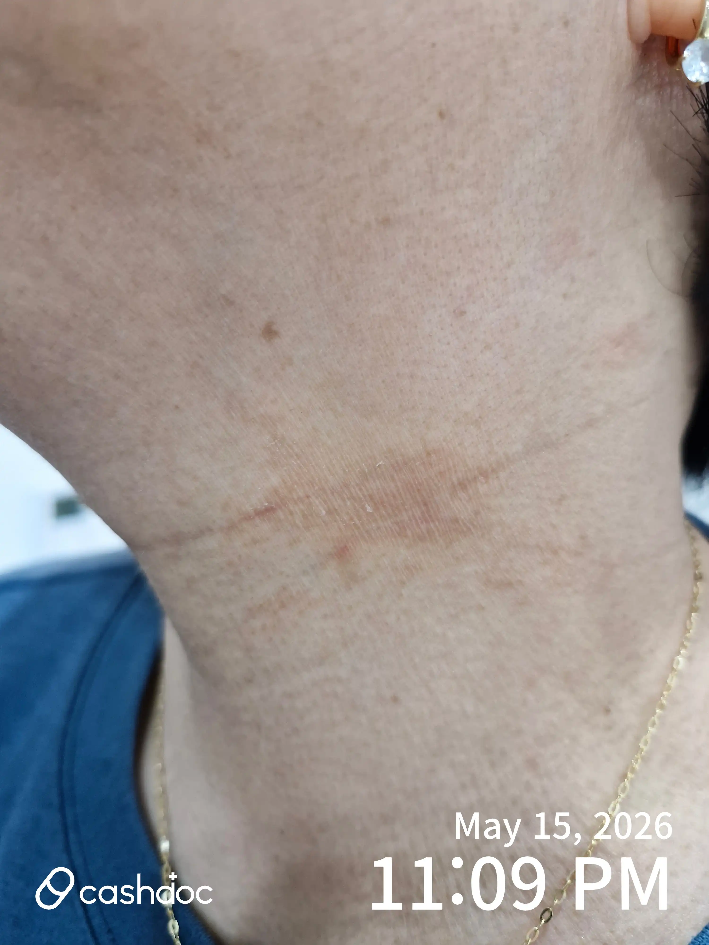 Review photo
