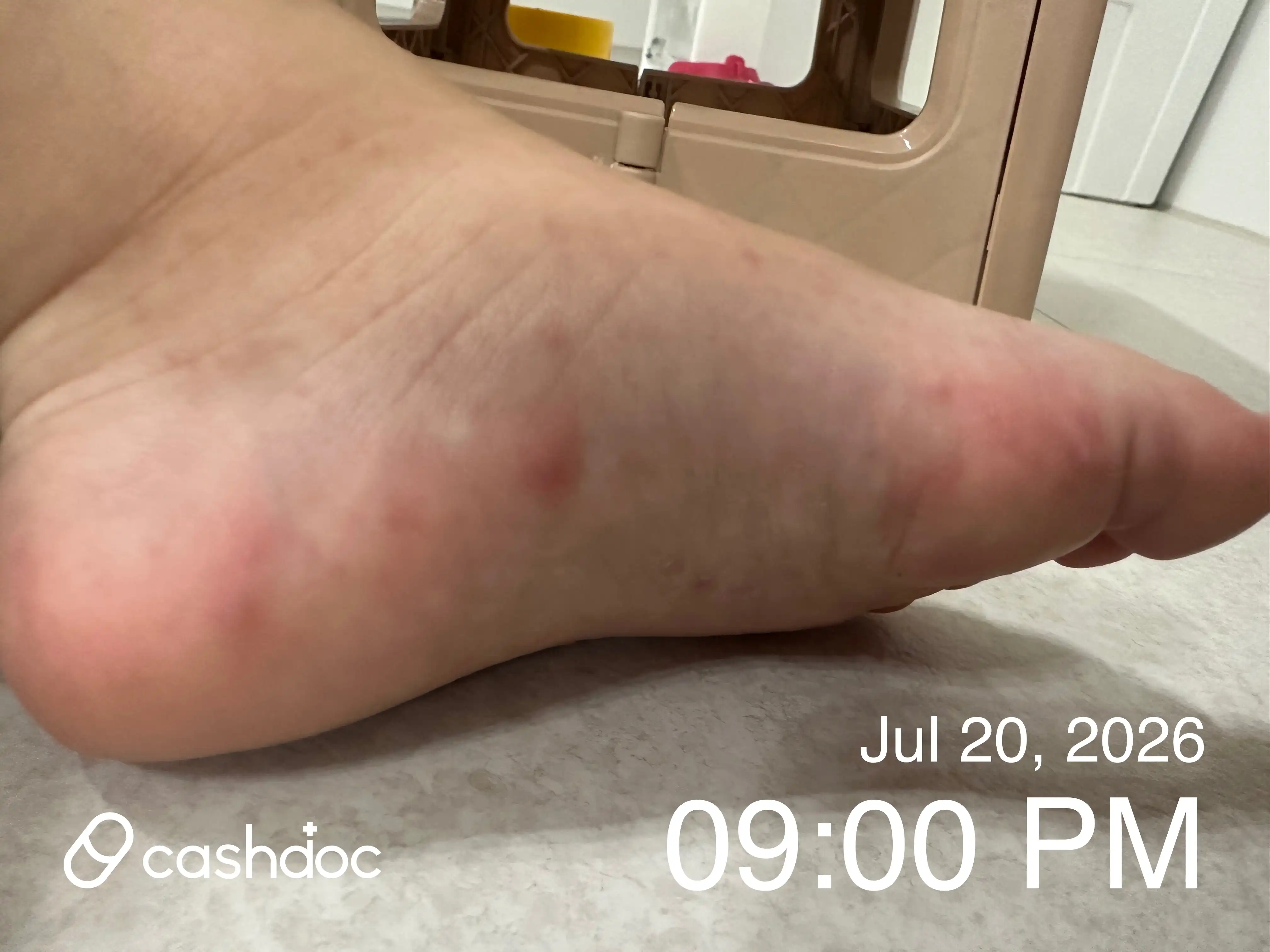 评价照片