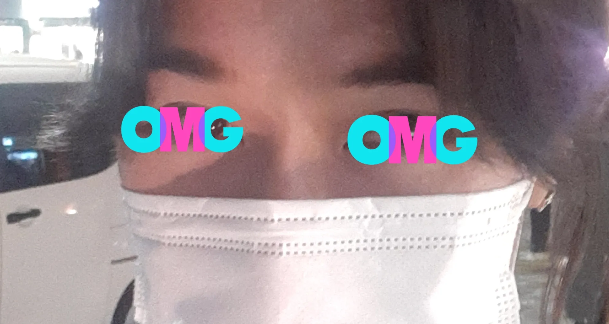 시술 후 — 잘~빠진 민트 하이코!