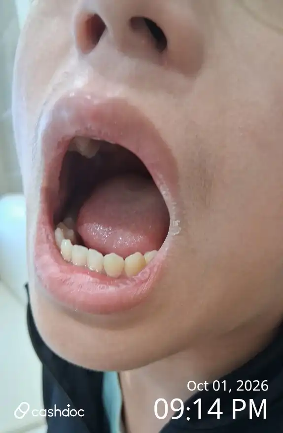评价照片