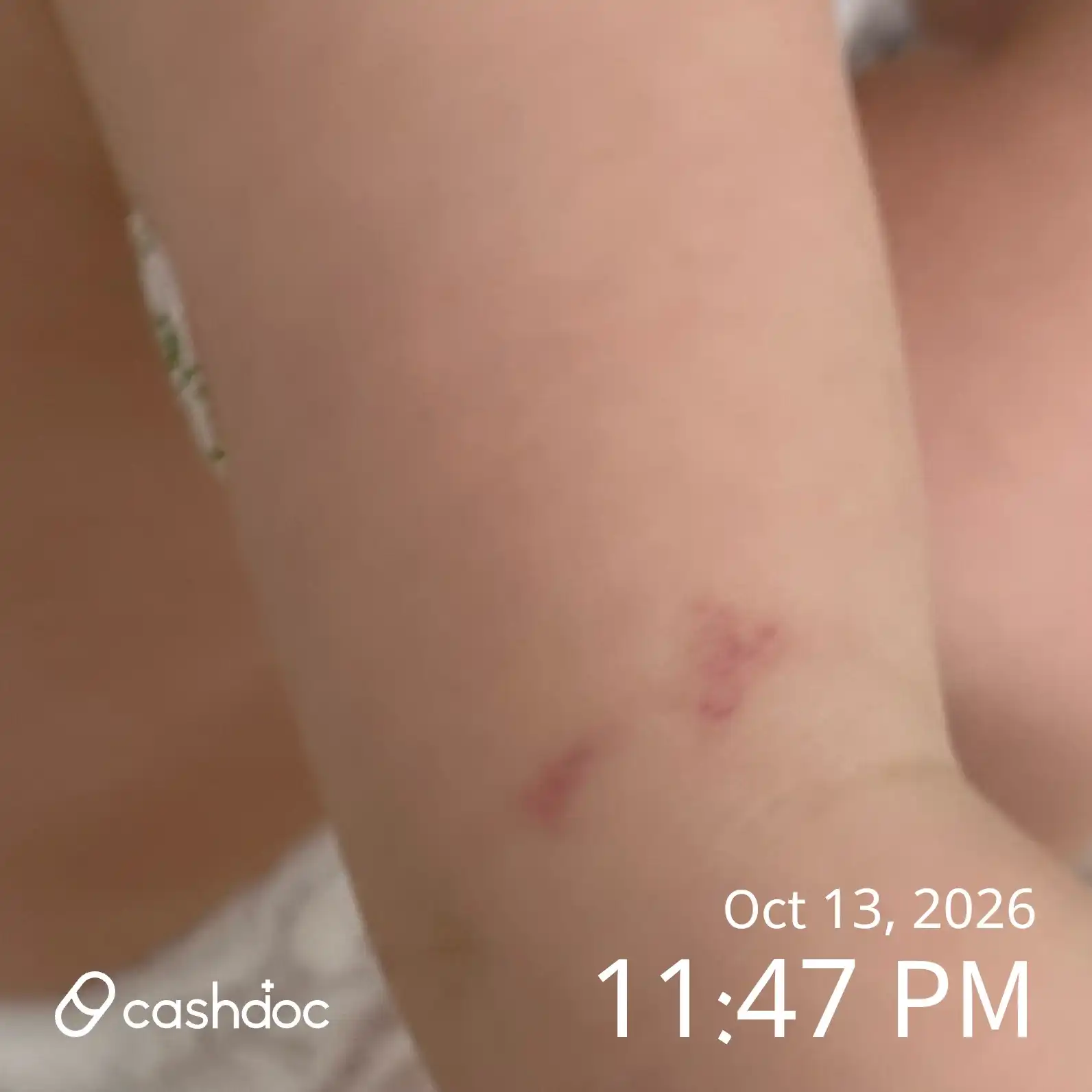 Review photo