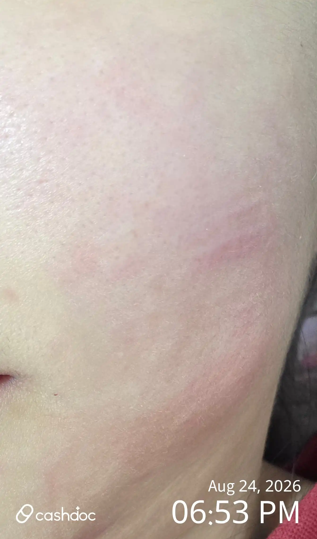 评价照片