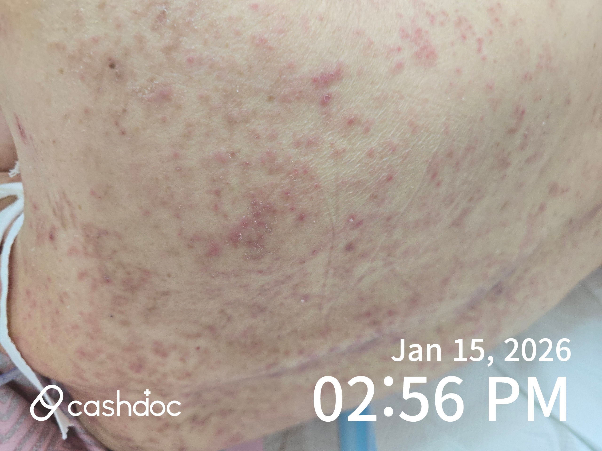 미추홀구 원광효도요양병원, 부모님 건강 악화 경험공유