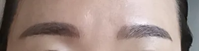시술 후 — 초간편 반영구 패키지