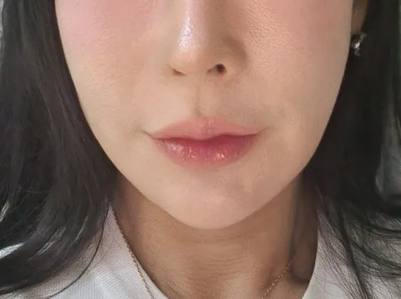 评价照片