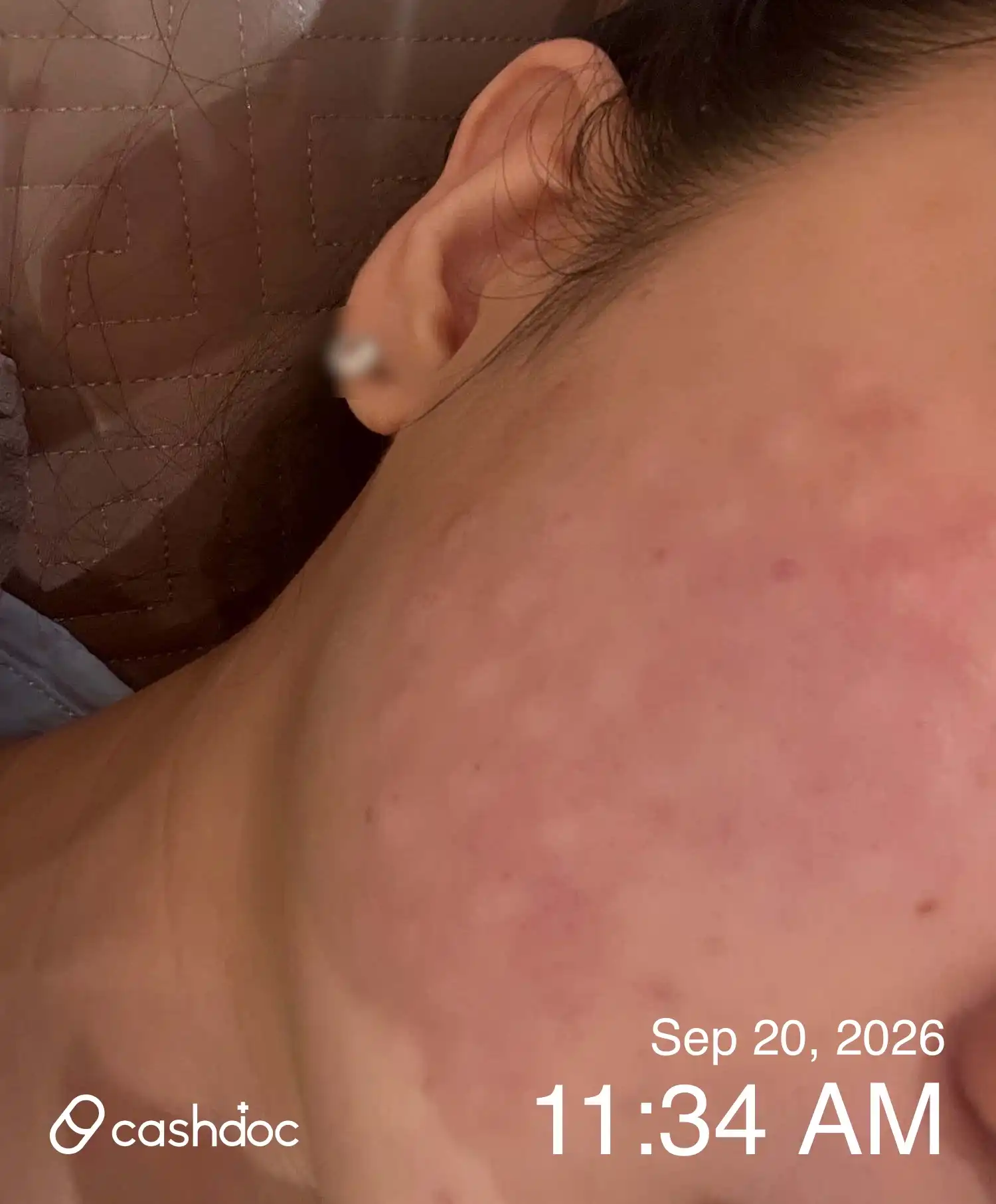 Review photo