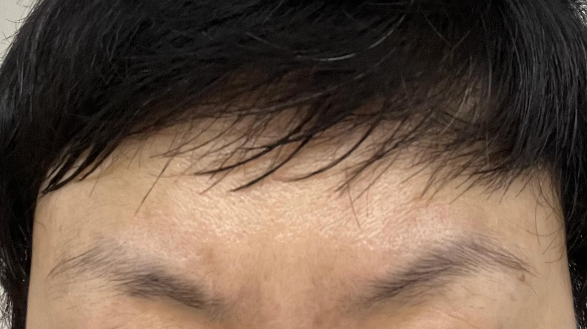 시술 전 — 미케이 반영구_눈썹, 입술, 아이라인