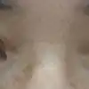 後