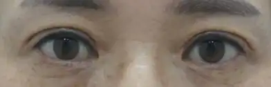 후