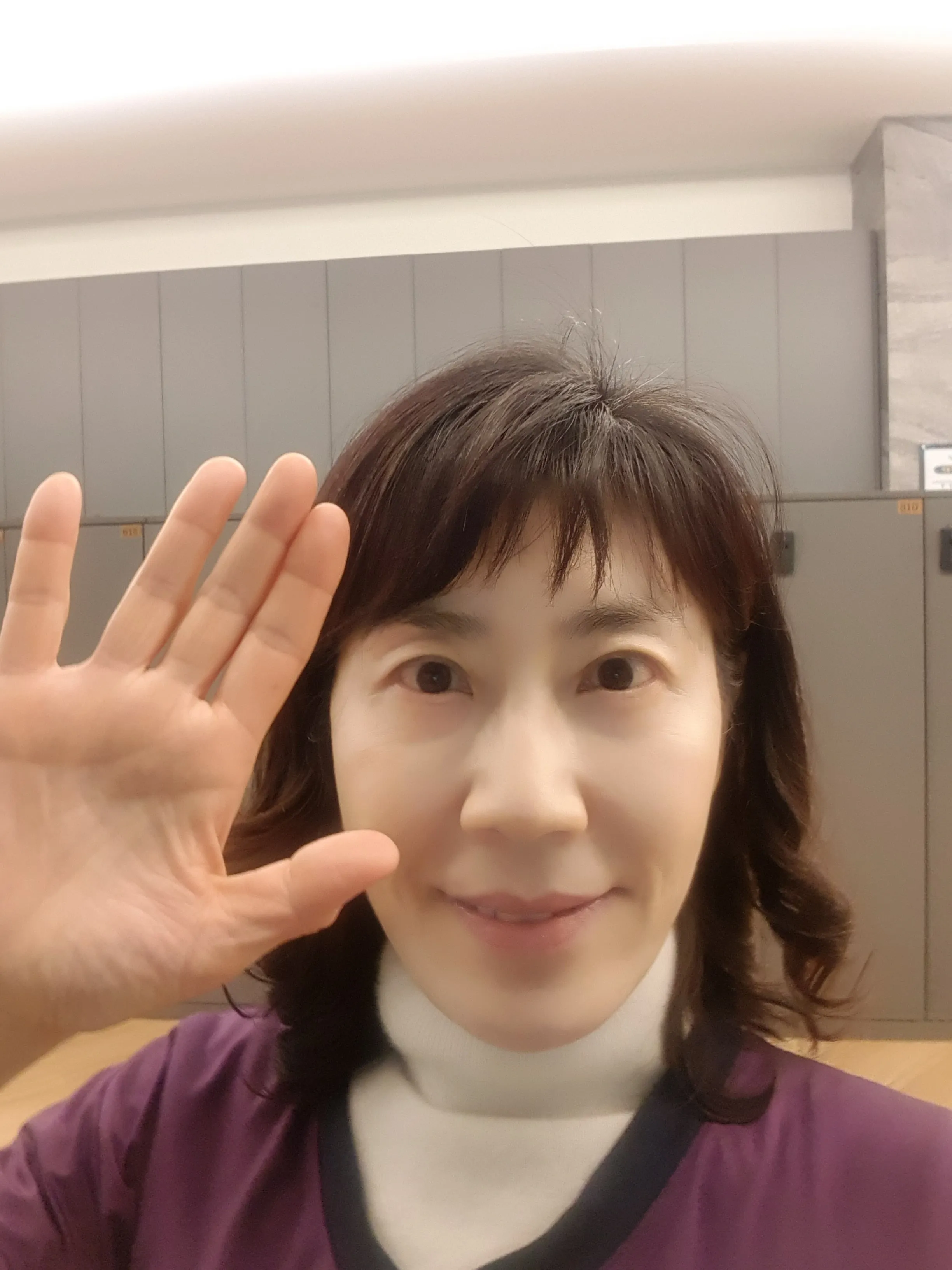 시술 전 — 미케이 주름&사각턱 보톡스