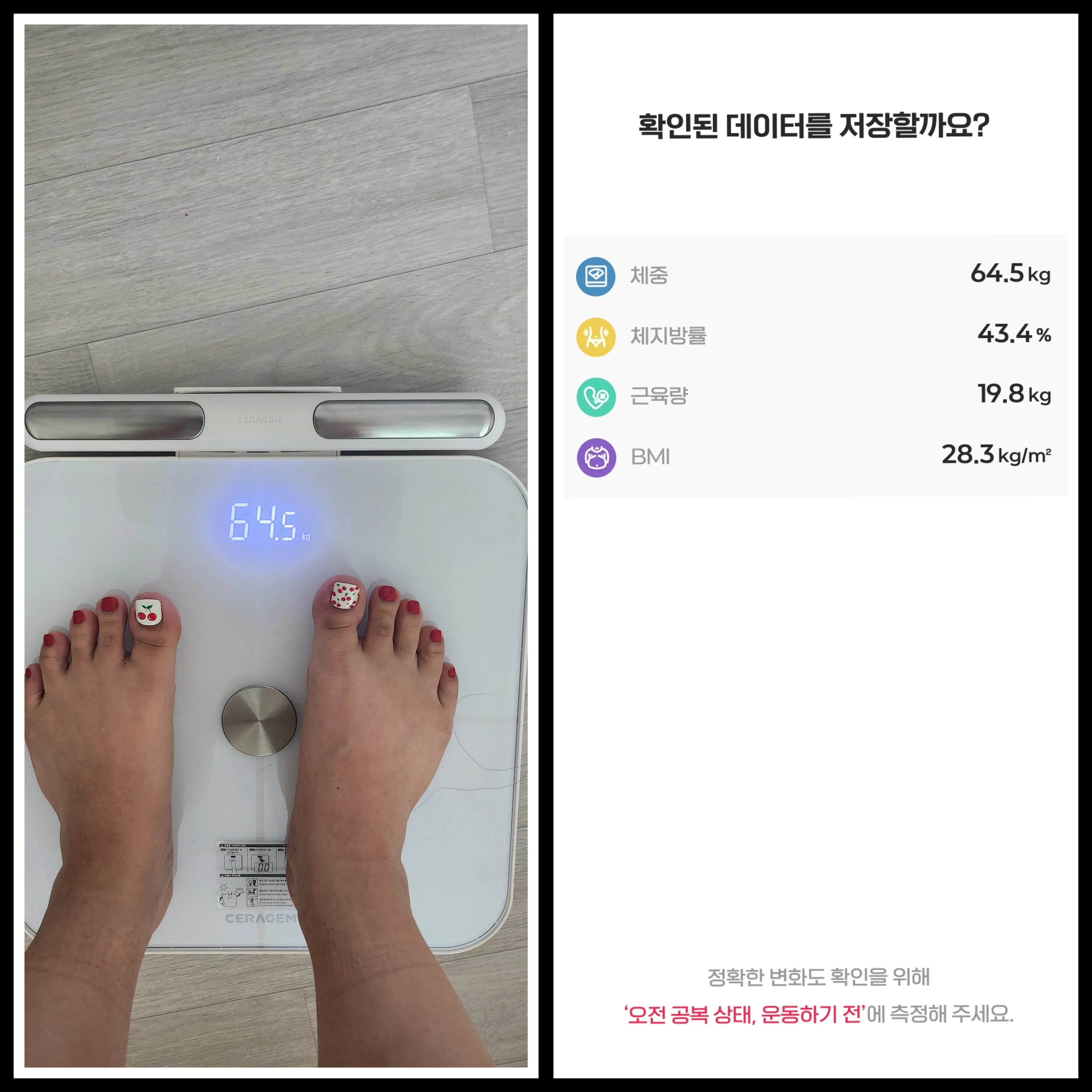 시술 후 — 자연과한의원 다이어트 지방사약 처방