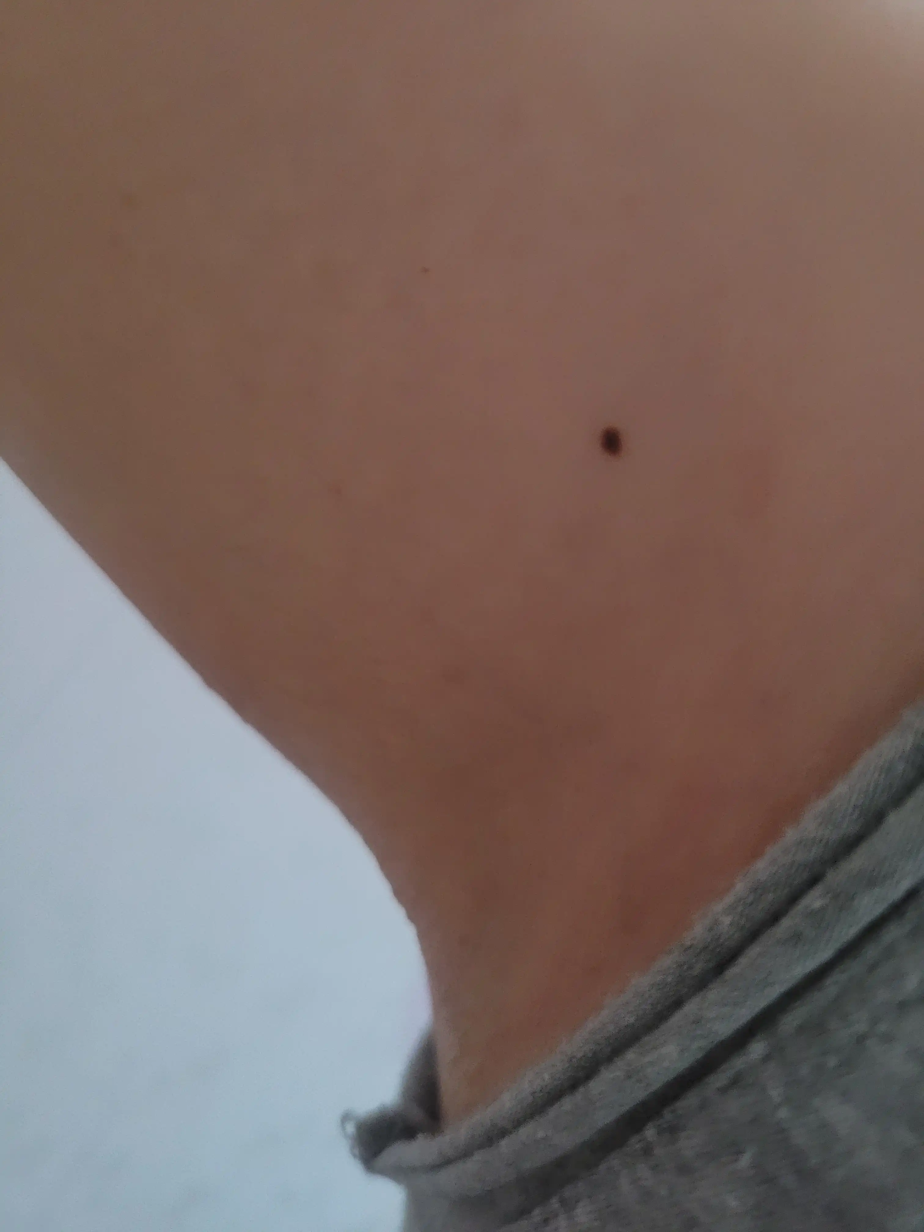 후