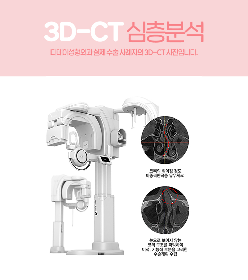 디데이성형외과의원 💖디데이 코재수술💖 이벤트, 시술 상세 이미지