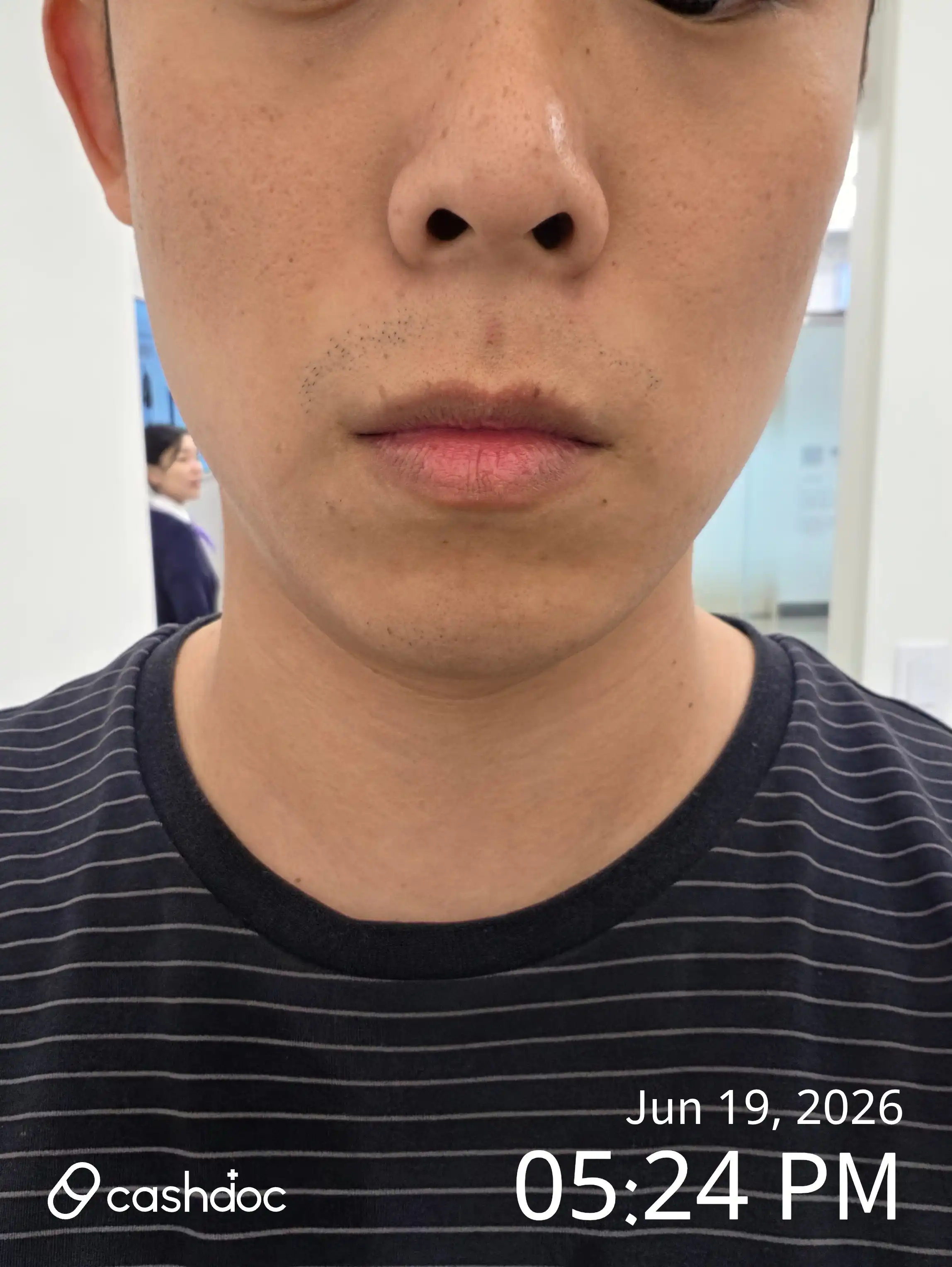 评价照片