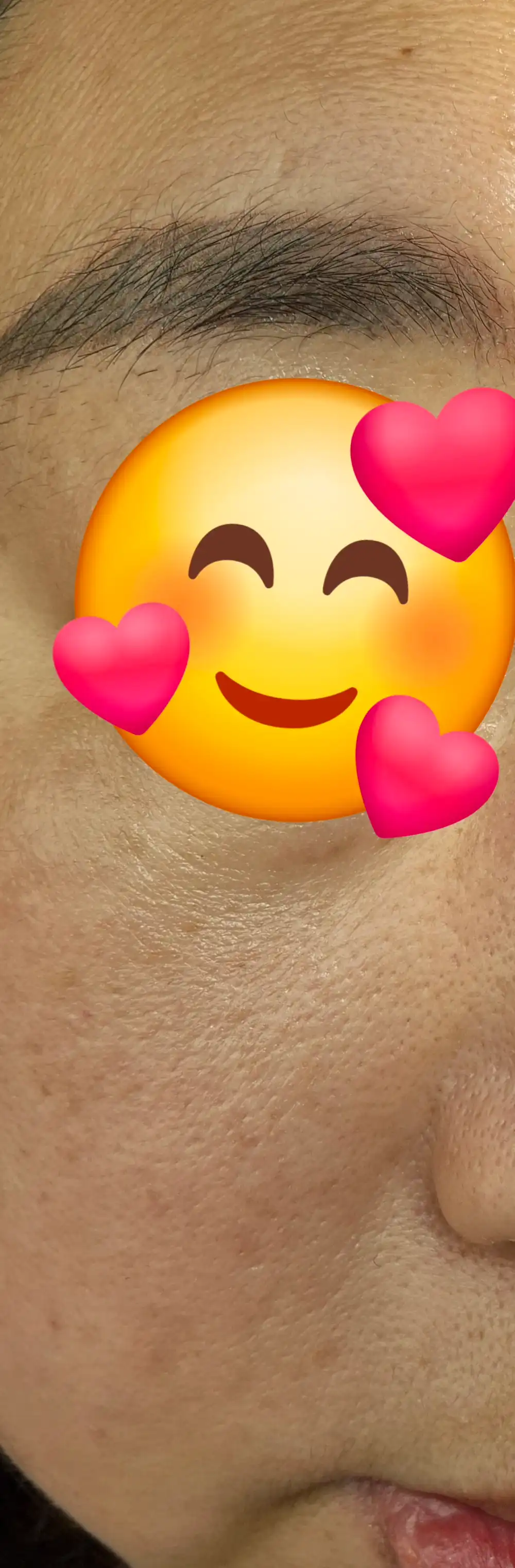 후