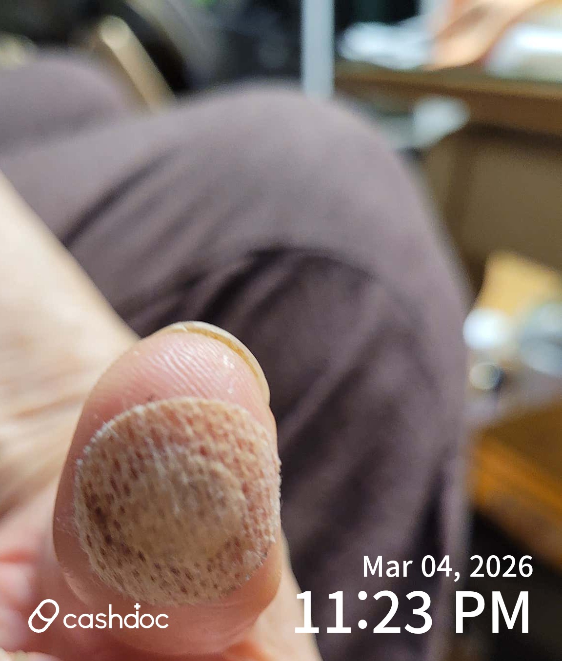 영등포구 최혜석이비인후과의원, 생선가시 제거 후기