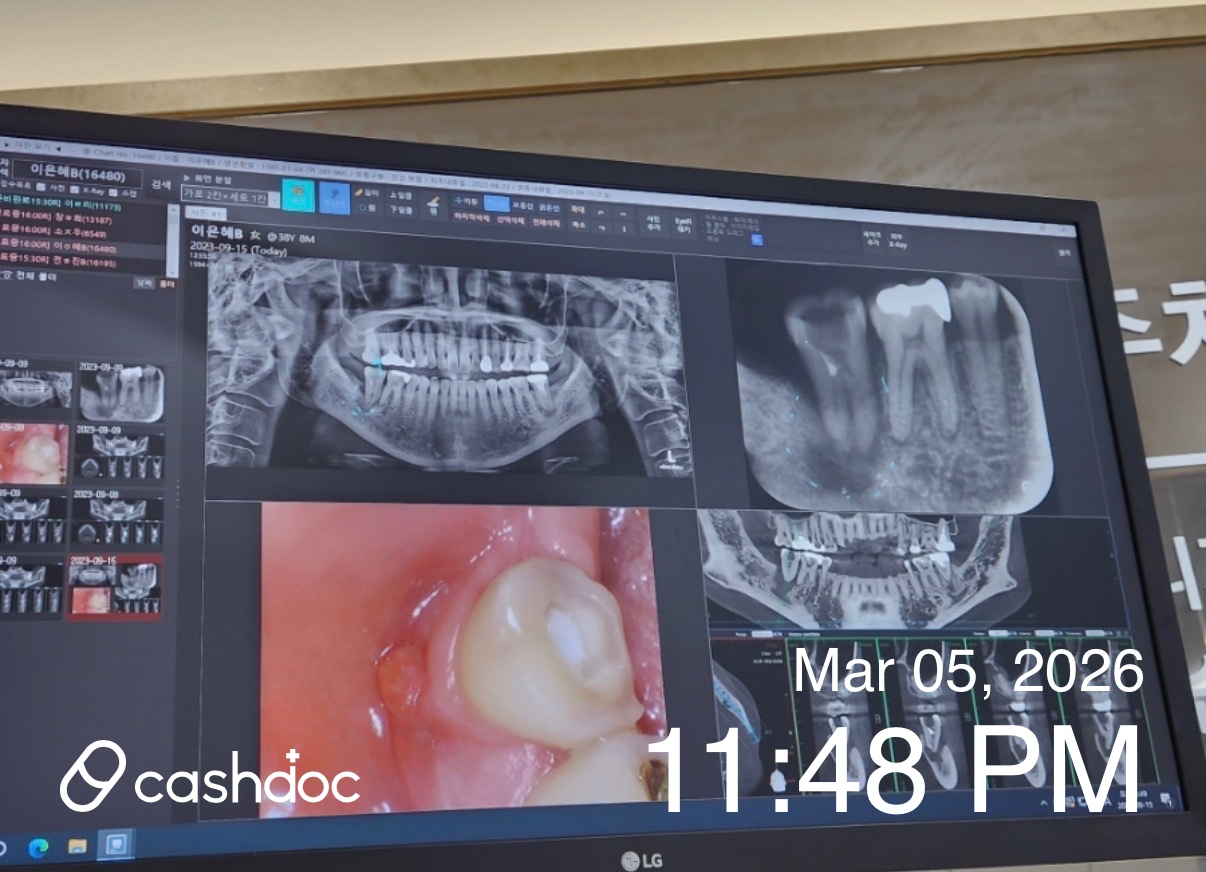 파주시 와이즈덴치과의원, 염증 임플란트 문제 친절하게 해결