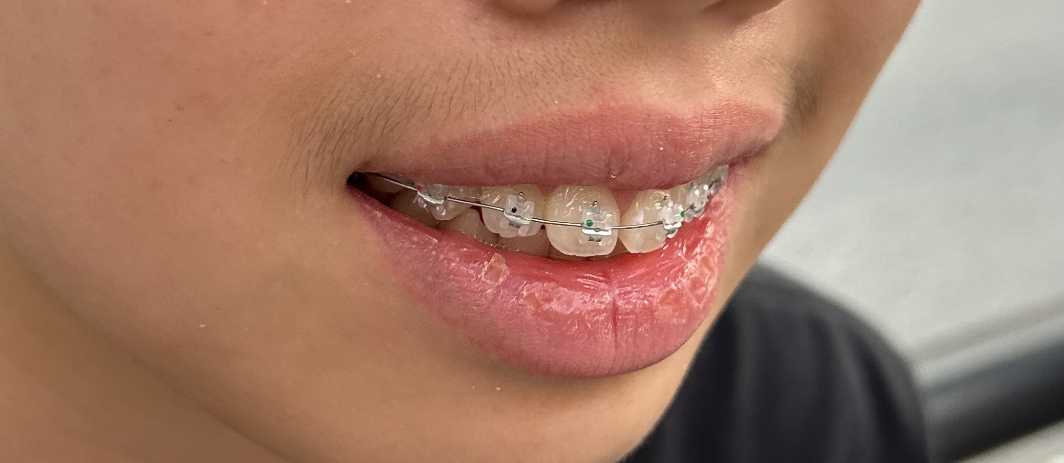 Review photo