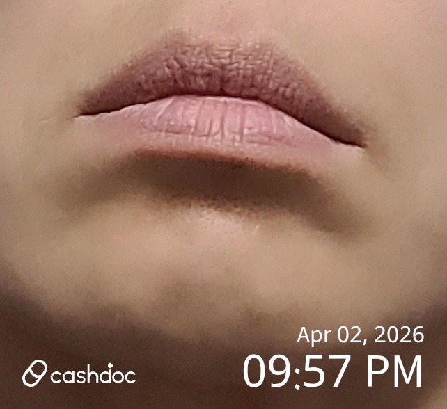 파주시 엘로디의원, 고가에도 불구하고 효과는 미지수