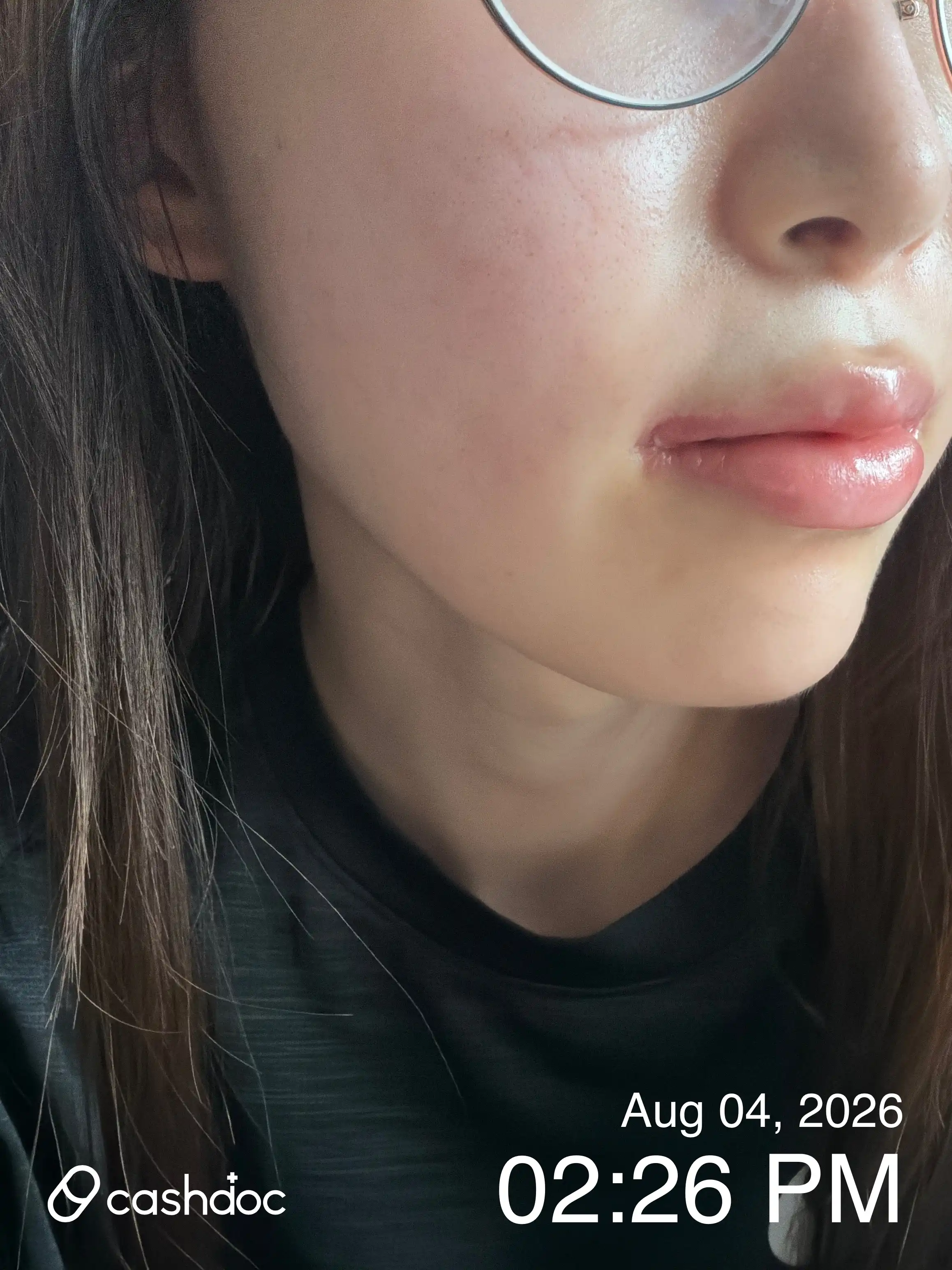 评价照片