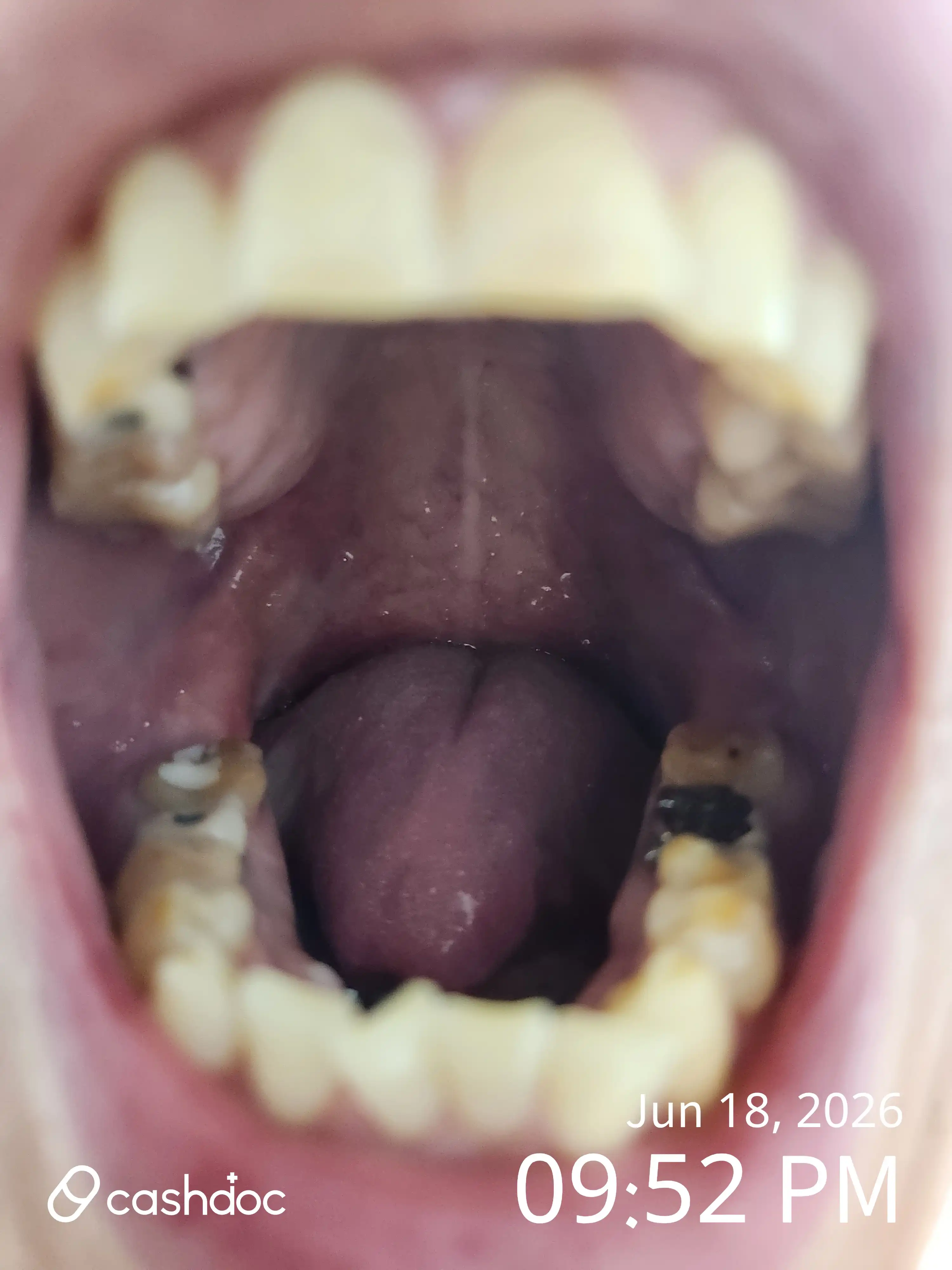 Review photo