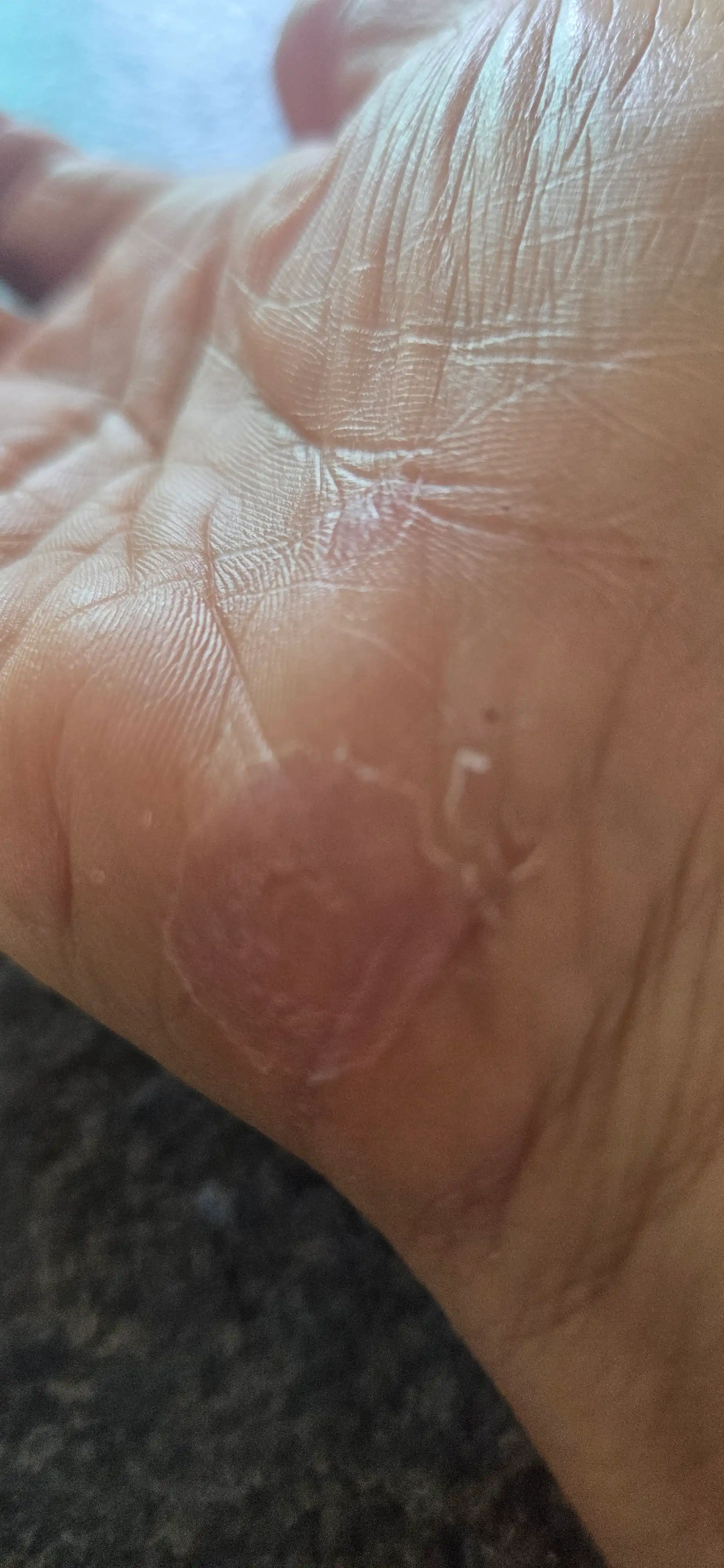 评价照片