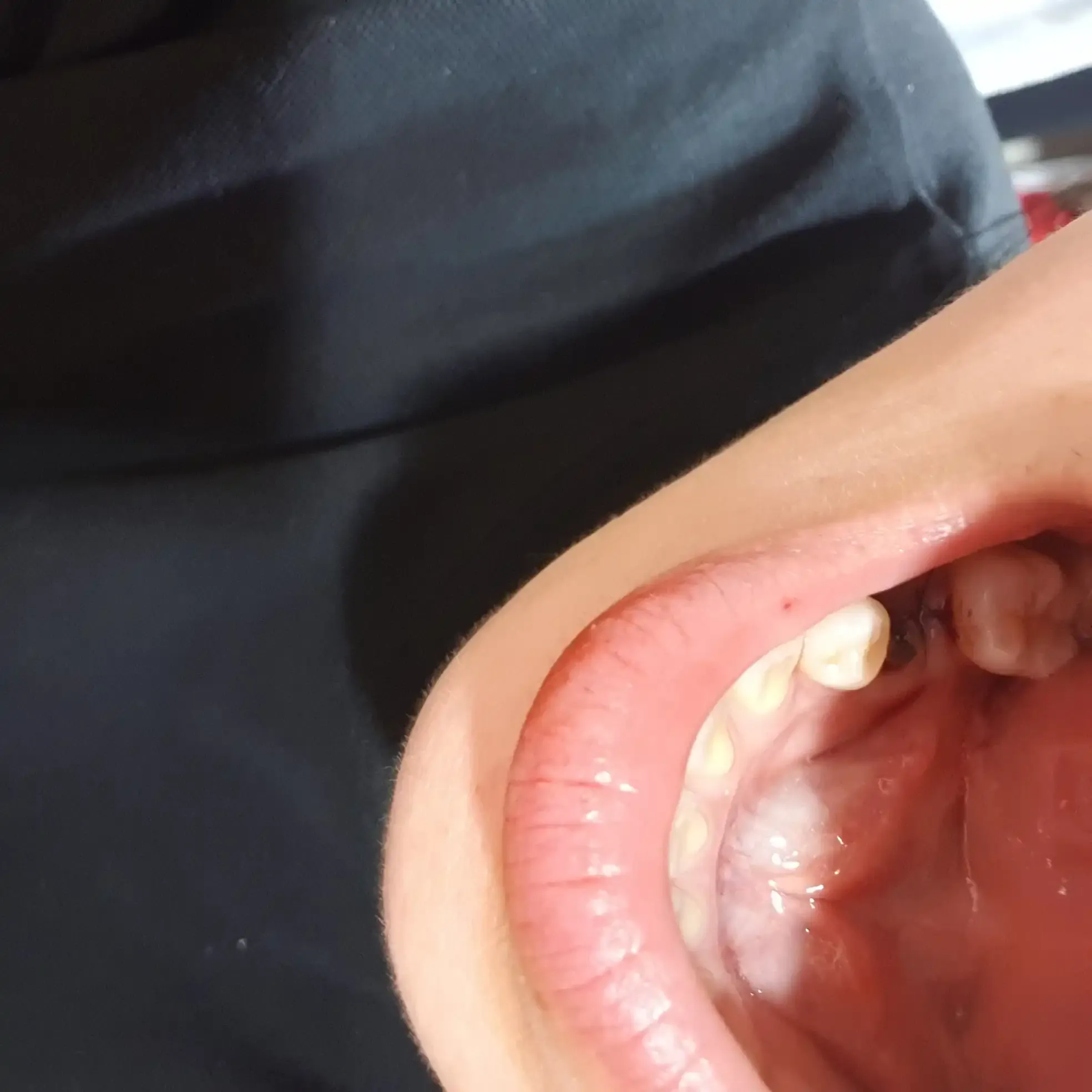 术后照片