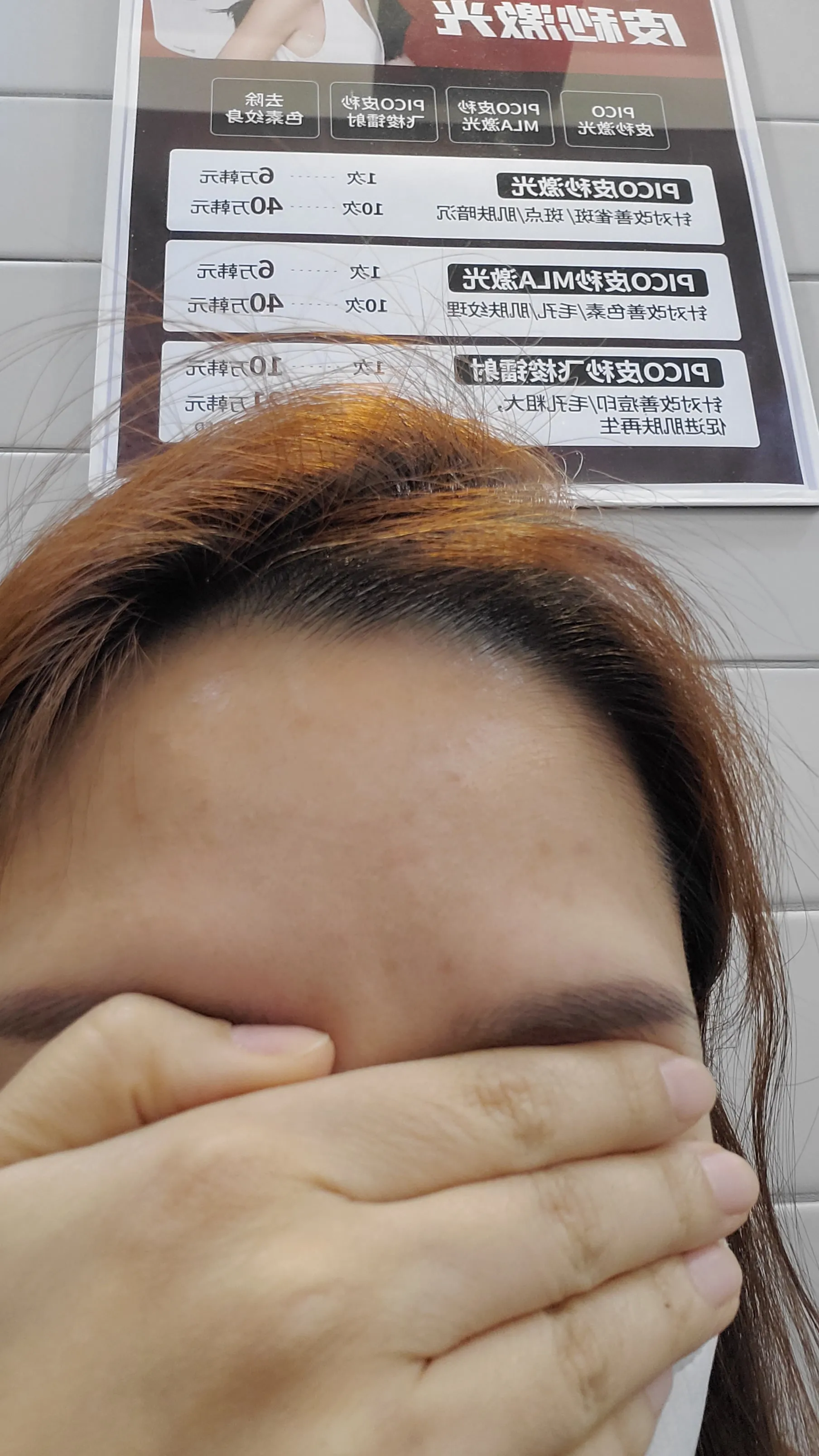 시술 후 — [앵콜]강남점_주름 보톡스 4900원