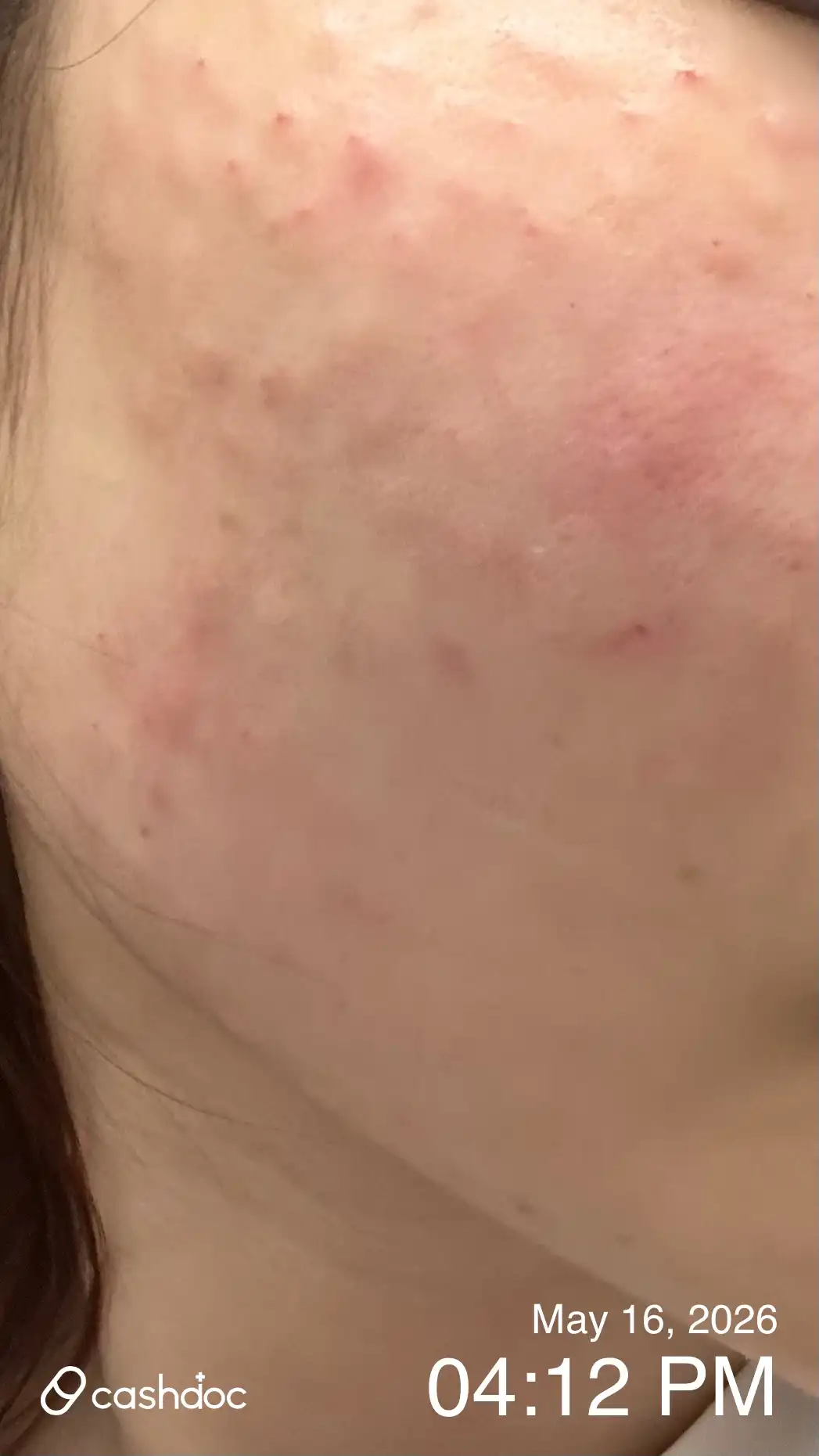 评价照片