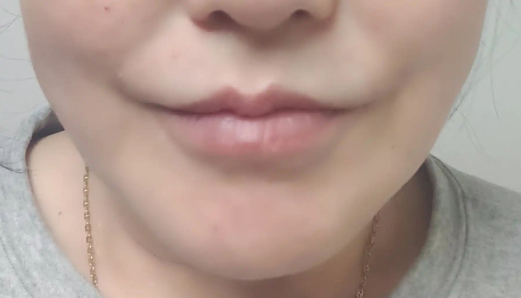 후